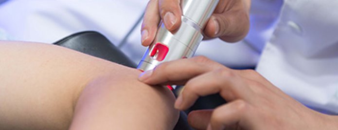 레이저치료 시술 사진