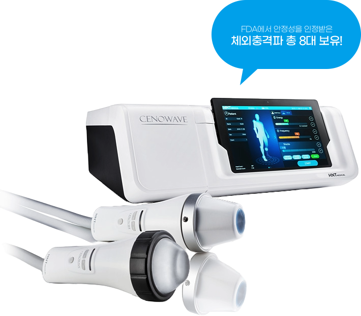 체외충격파 장비 사진